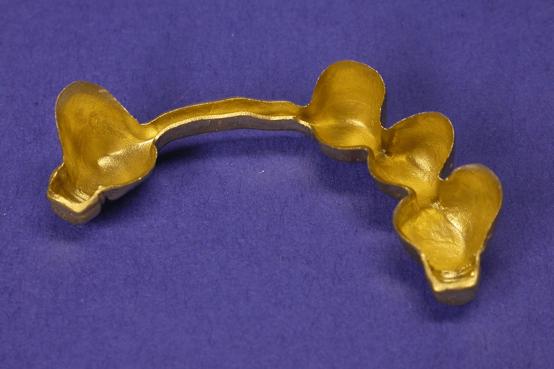 Galvano-Gold Gerüst