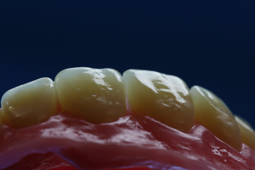 Kunststoffzähne
